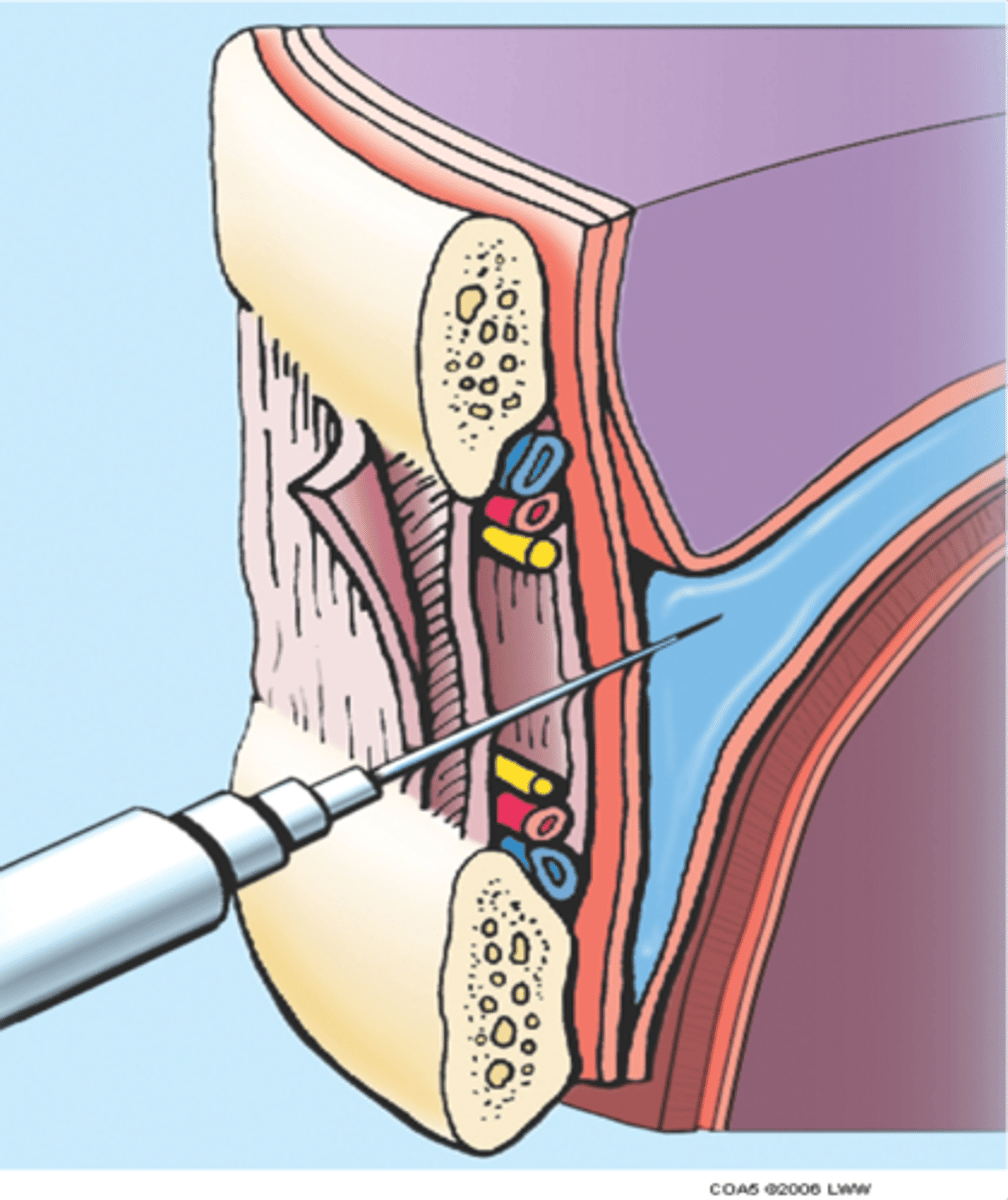 <p>1. To drain or sample fluid (pleural fluid, blood, pus) from pleural cavity. </p><p>2. Anaesthetise ('block') an intercostal nerve.</p>