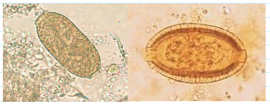<ul><li><p><span>Must not confuse with Trichuris eggs</span></p></li><li><p><span>35-45 x 20-25 um</span></p></li><li><p><span><u>More squarish than Trichuris eggs</u></span></p></li><li><p><span>Less conspicuous polar plugs</span></p><ul><li><p><span>Flatter and less prominent</span></p></li></ul></li><li><p><span><u>Thick striated shell</u></span></p></li></ul><p></p>