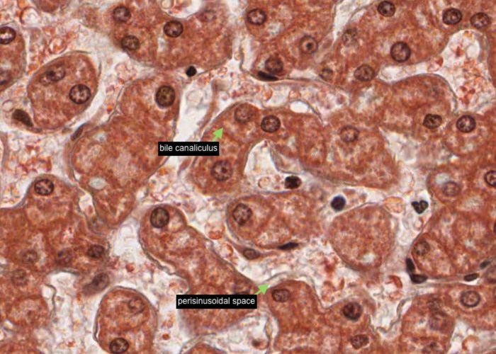 Liver - Perisinusoidal space (Space of Disse)