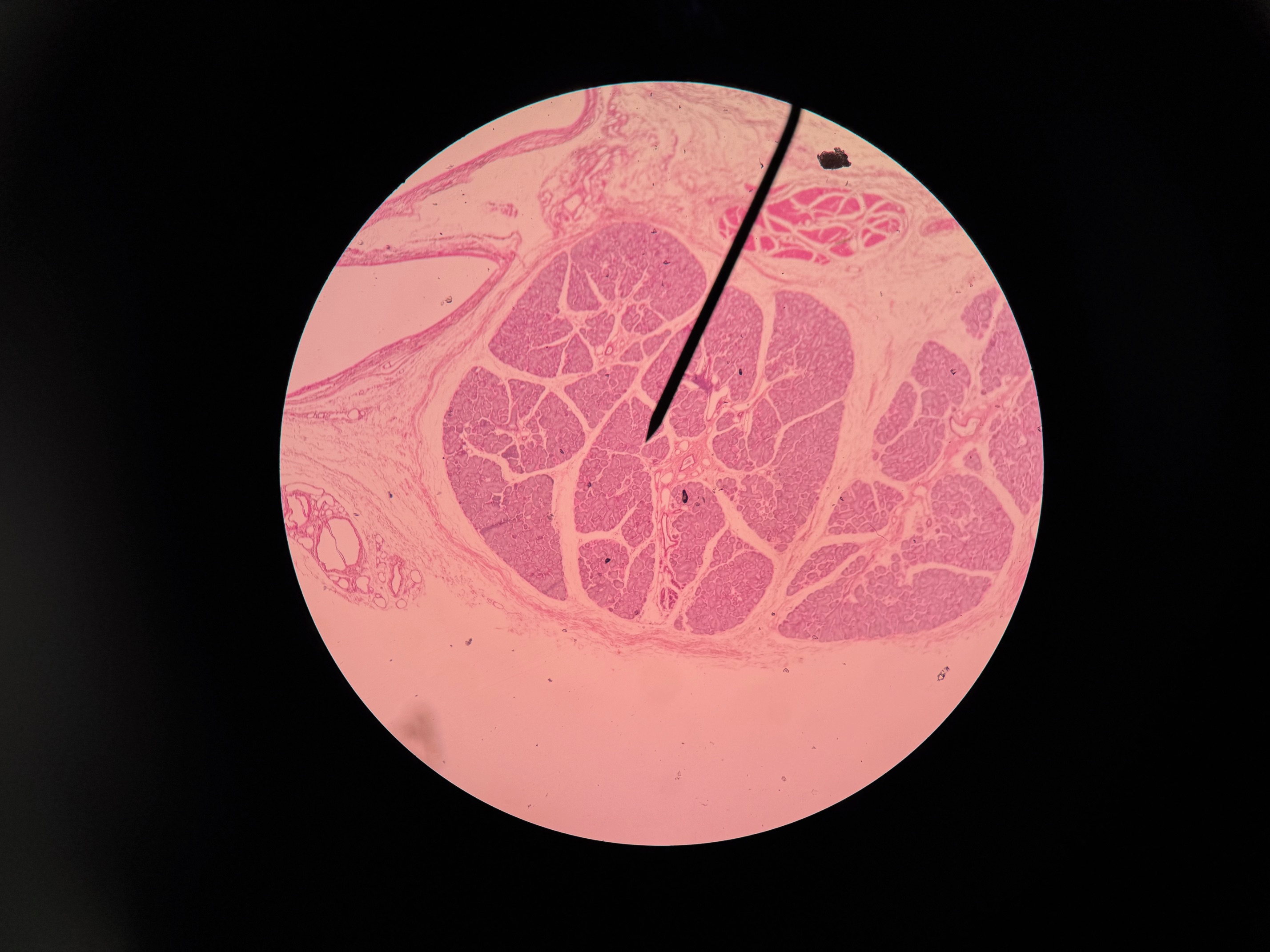<p>Organ?</p>