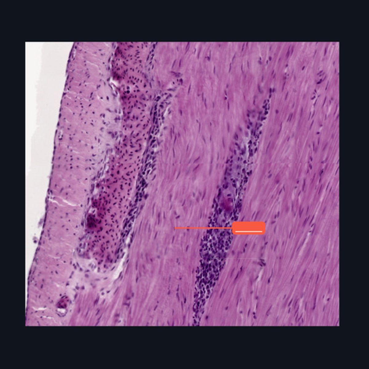 <p>Identify the structure</p>