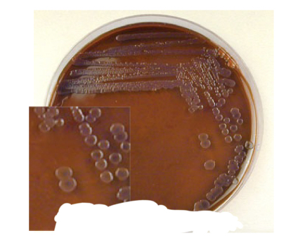 <p>Eosin Methylene Blue Agar (EMB) results</p>