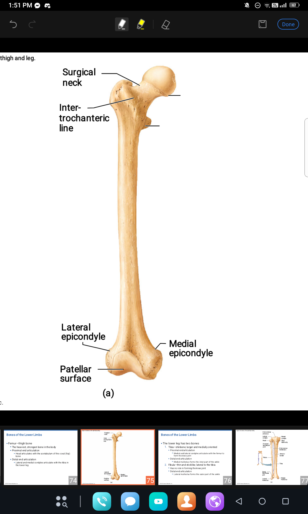 <p>LONG BONE (proximal part)</p>