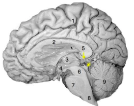 <p>Which of the following statements regarding the photograph of the medial surface of the human brain to the right is true?</p>