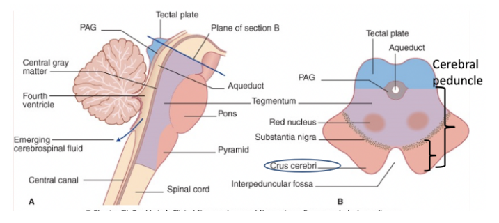 <ul><li><p>We find the rest — the old descending pathways, ascending pathways, nuclei of the cranial nerves and the specific nuclei of the brainstem</p></li><li><p>Contains the reticular formation —</p><ul><li><p>Important because it is both the oldest part of the brainstem but also contains all our vital centers</p></li><li><p>Here we can also find the cranial nerve nuclei, the specific nuclei, the sensory &amp; motor pathways (except the pyramidal &amp; corticopontine tracts) </p></li></ul></li></ul>