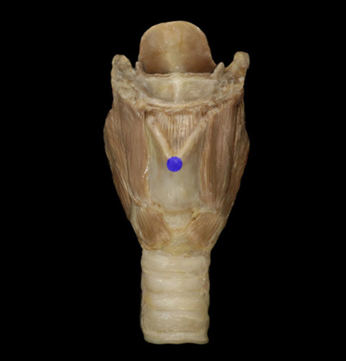 <p>The protrusion formed by the thyroid cartilage in the larynx.</p>