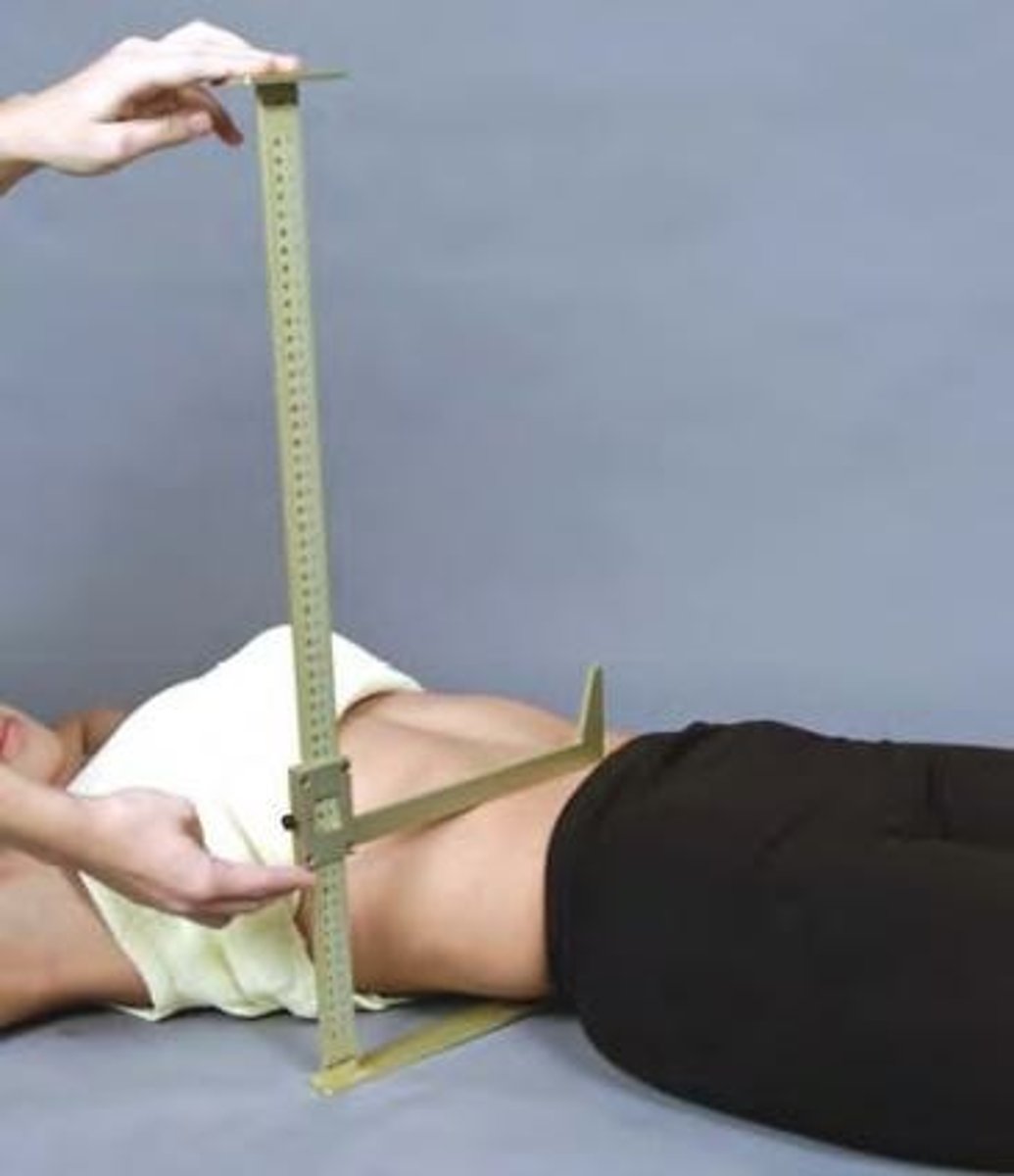 <p>A tool used to measure separations in treatment planning.</p>