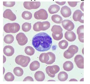<p><span style="font-family: Helvetica; font-size: 12px;">This cell is typically the largest mature peripheral blood cell:</span></p>