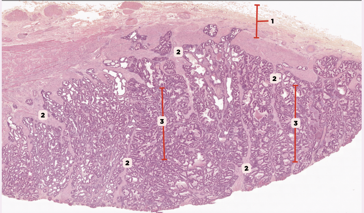 <p>Identify the structure labeled as 2.</p>