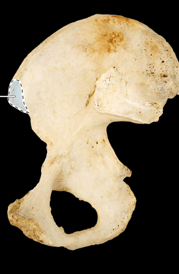 <p>Hip bone, medial view, right ilium</p>