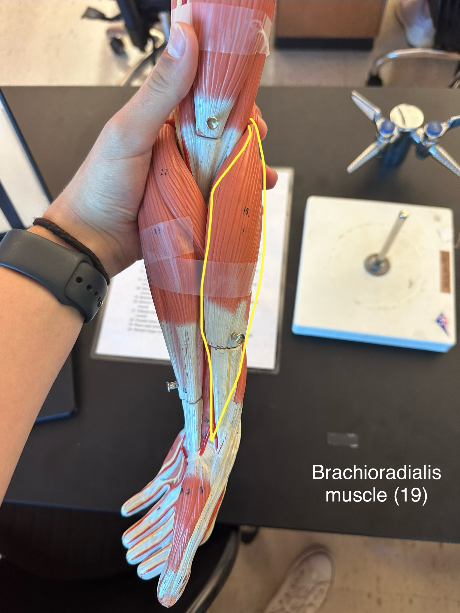 <p>Brachioradialis muscle</p>