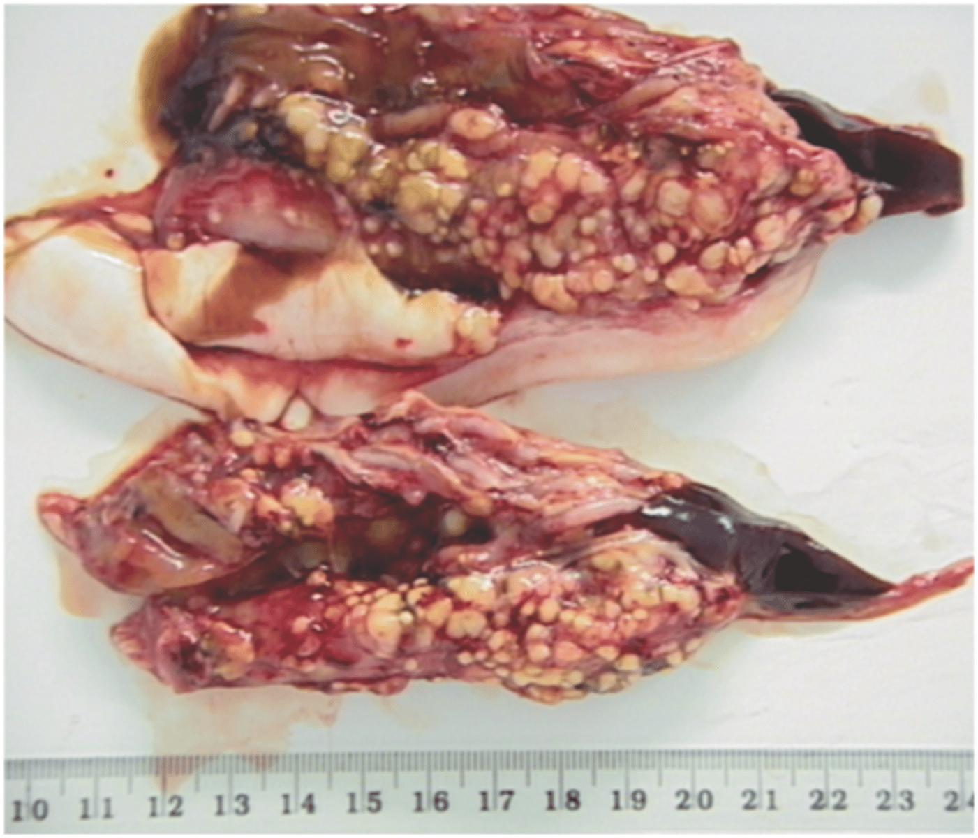 <p>The cysts of Diphyllobothrium are white and clearly evident on the intestine of fish.</p>