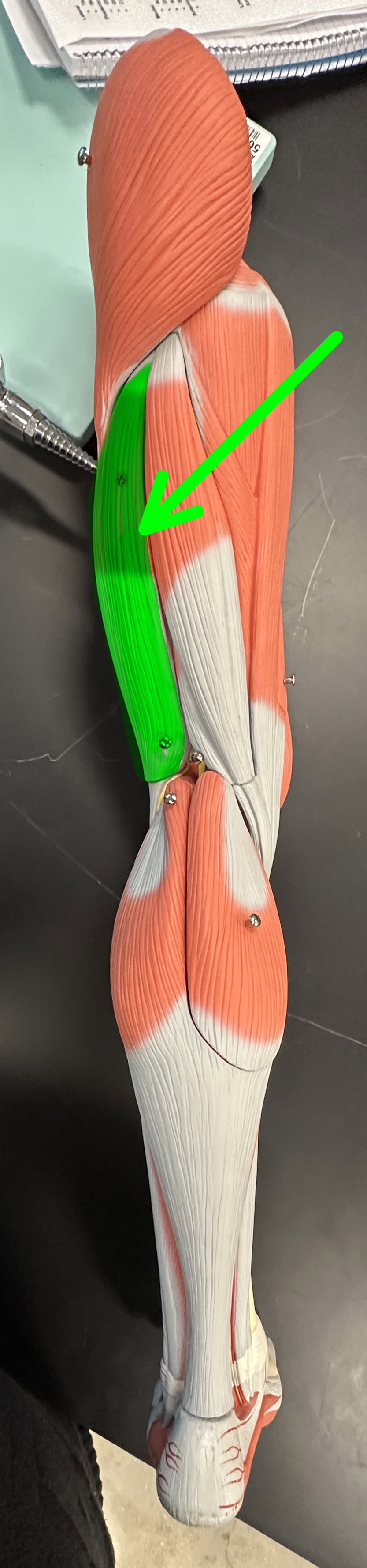 <p>What is the highlighted structure</p>