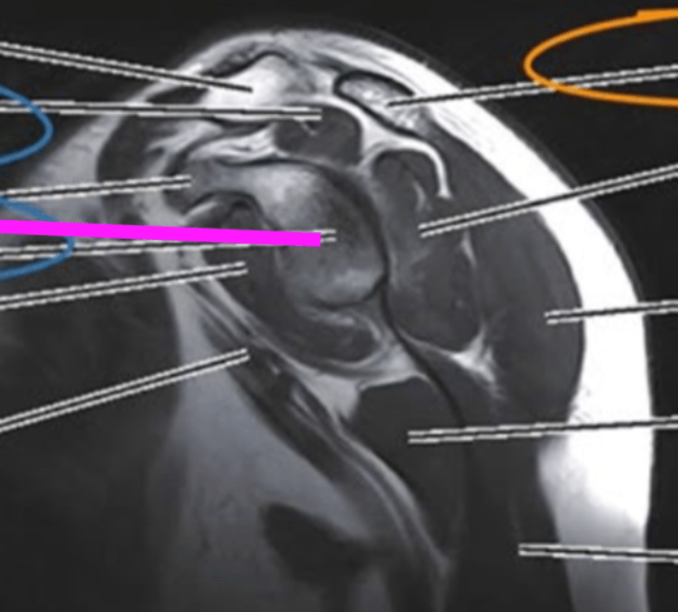 <p>what does the pink line point to?</p>