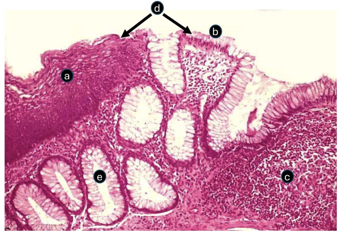 <p>A. ID the epithelium</p><p>B. ID the type of epithelium </p><p>C. ID the labeled structure </p><p>D. ID the labeled structure </p><p>E. Name two sites where you could find this kind of transition between two types of epithelium </p>