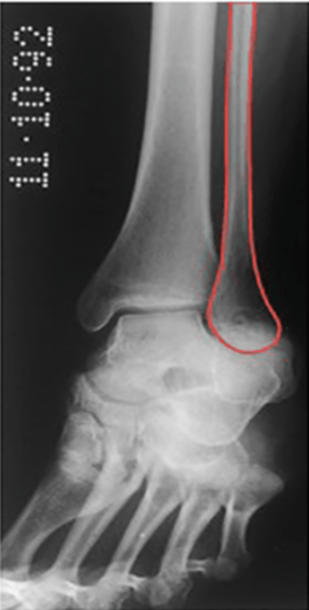 <p>What structure is highlighted?</p>