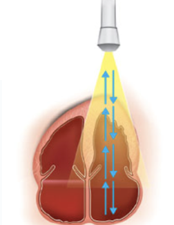 <p>Continuous generation of ultrasound coupled with continuous ultrasound reception</p>