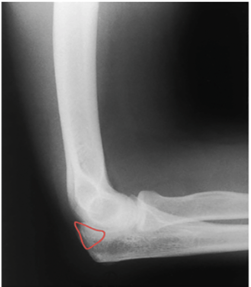 <p>What structure is highlighted?</p>