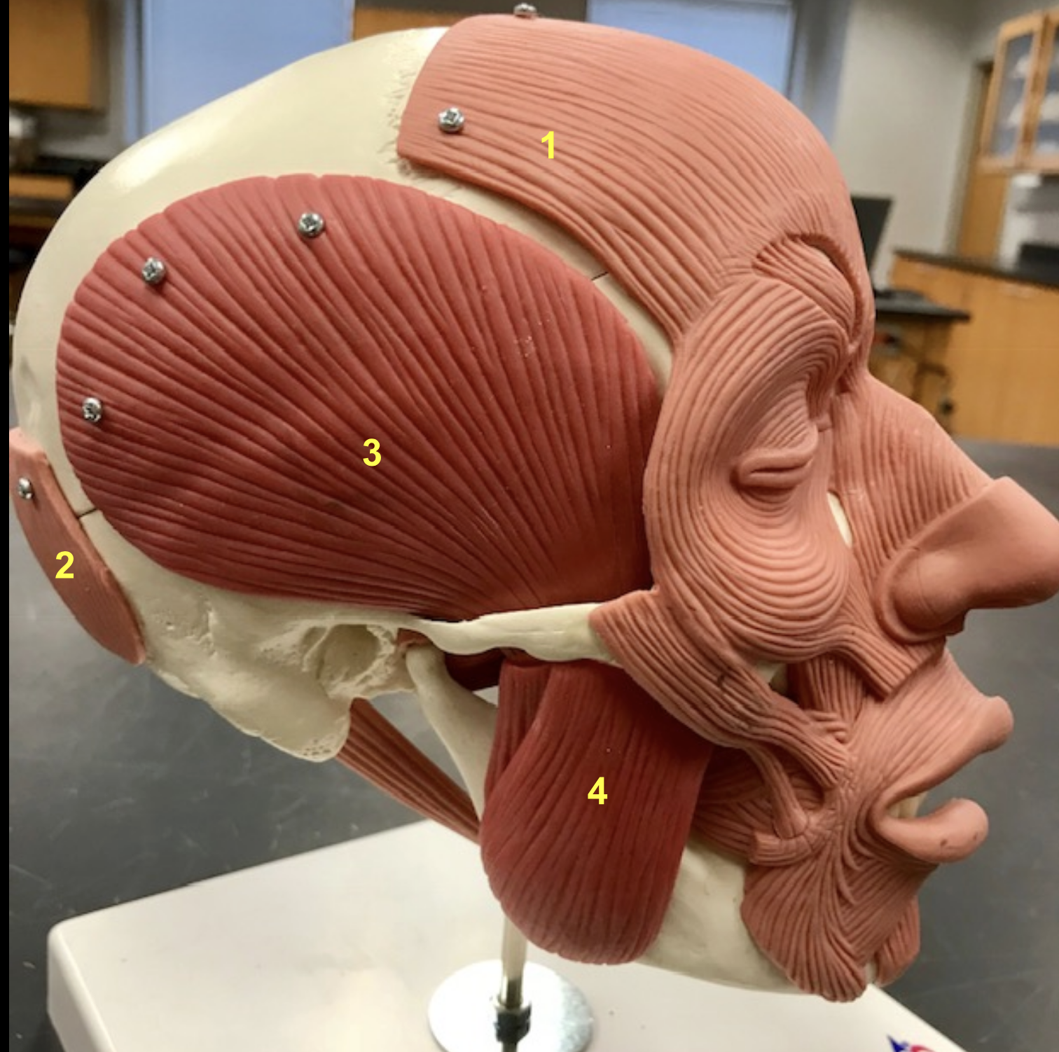 <p>What is the primary function of the <span style="color: #54ff29">Orbicularis Oculi </span></p>
