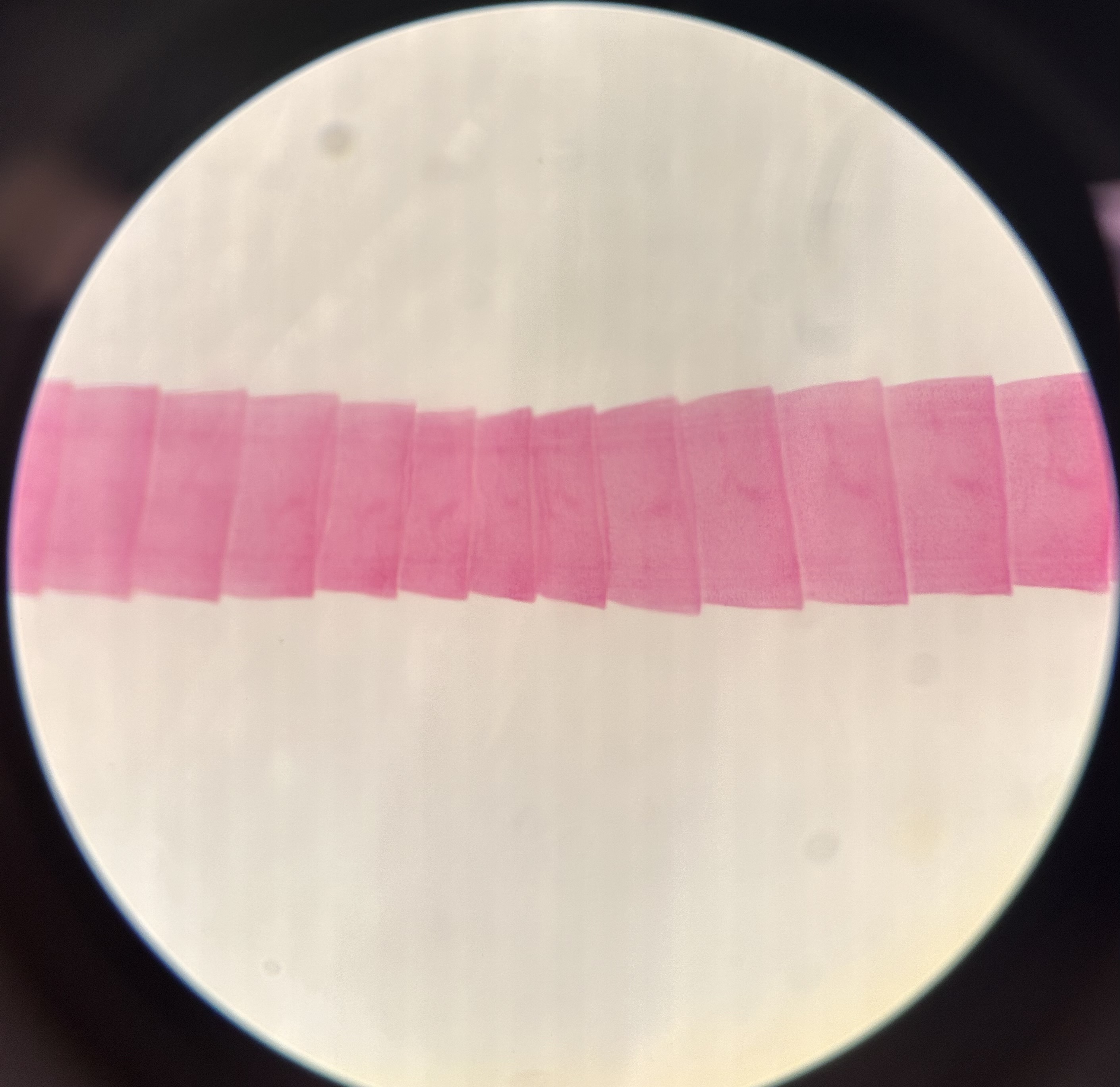 <p>Identify the organism and the Class it belongs to</p>