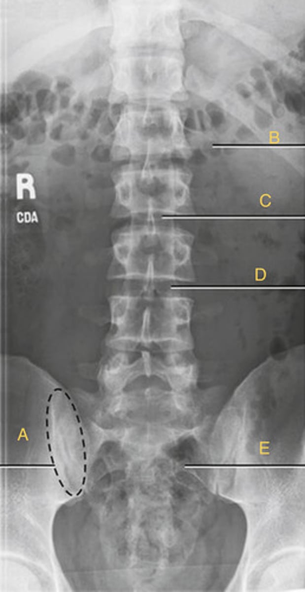 <p>What position?</p>