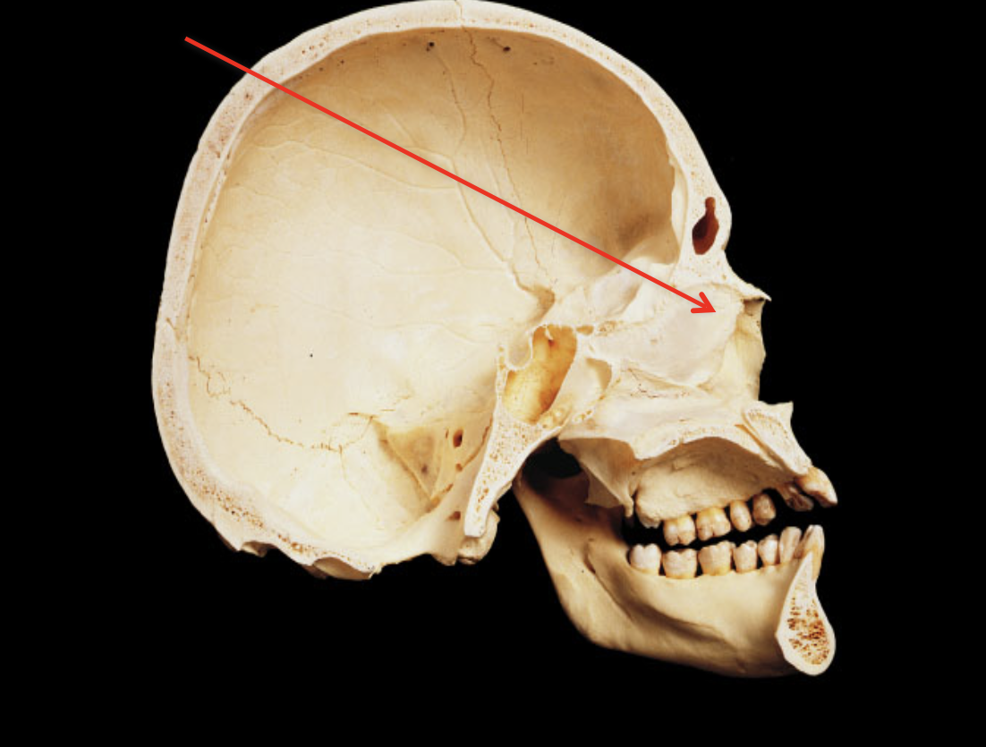 term image