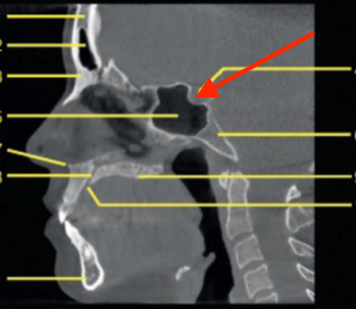 <p>identify the structure </p>
