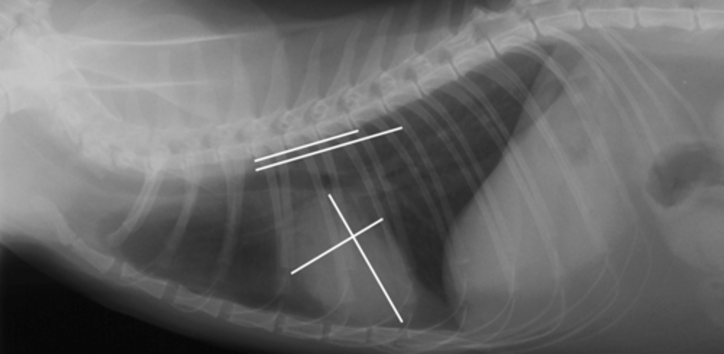 <p>Given the following radiograph do we have an enlarged heart?</p>