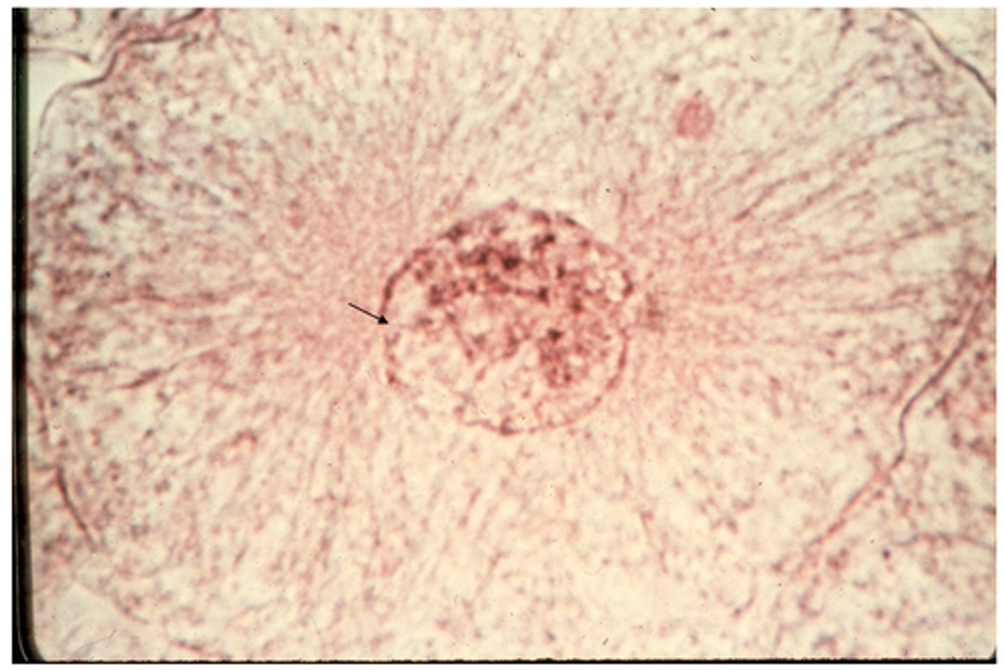 <p>This shows ________ in whitefish blastula.</p>