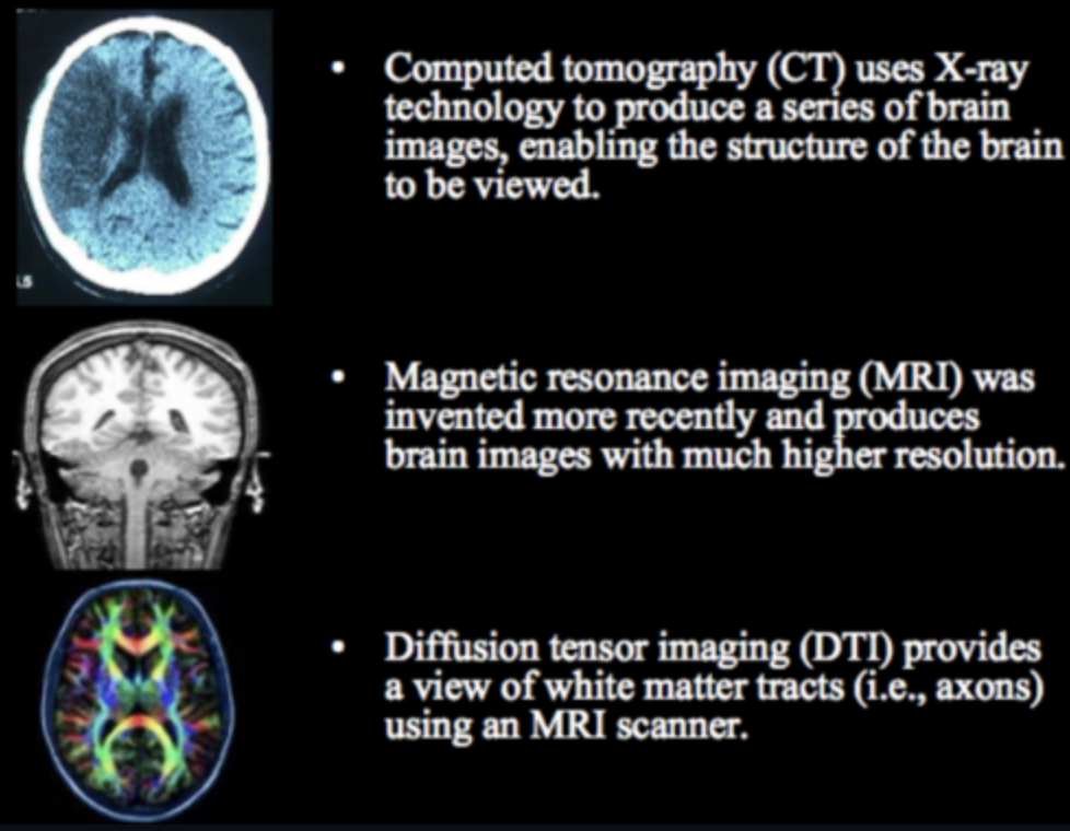 CT, MRI, DTI