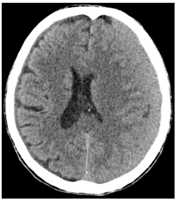 <p>What is this CT image showing?</p>