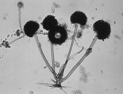 fungi phylum that contains common bread molds