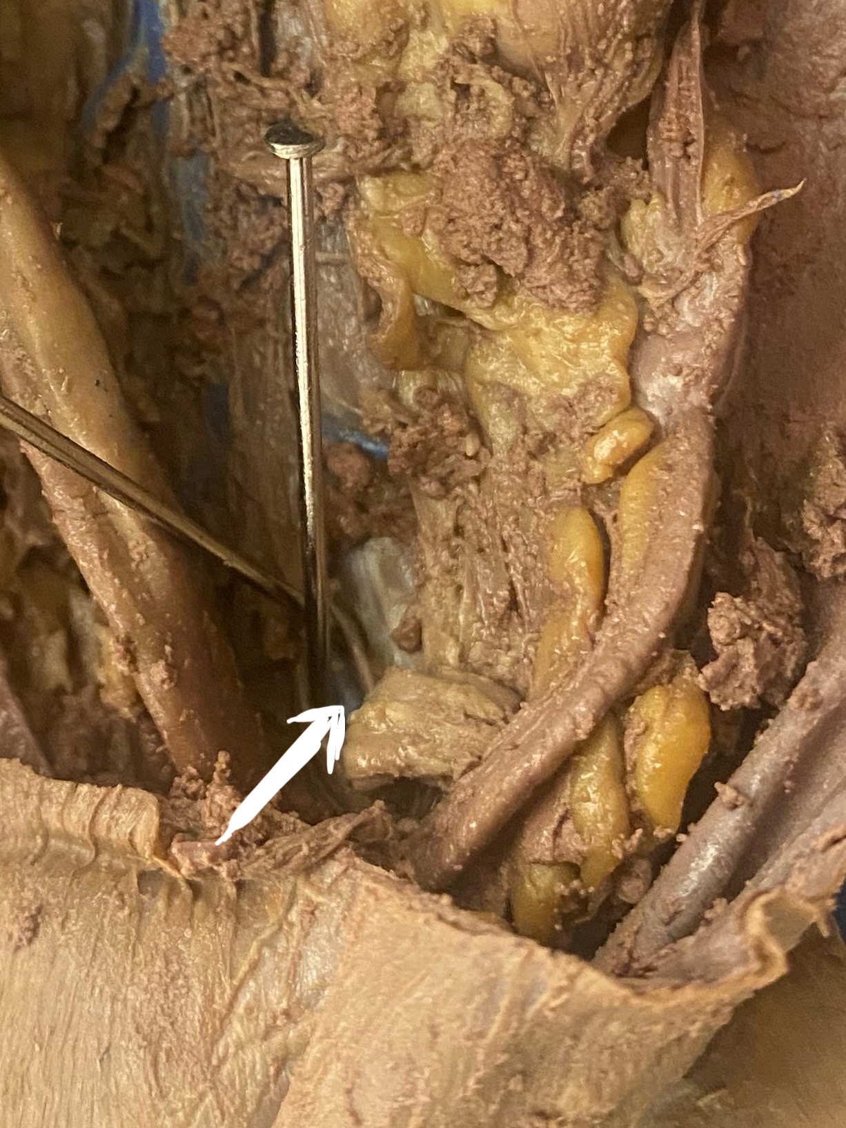 <p>What’s this?</p>