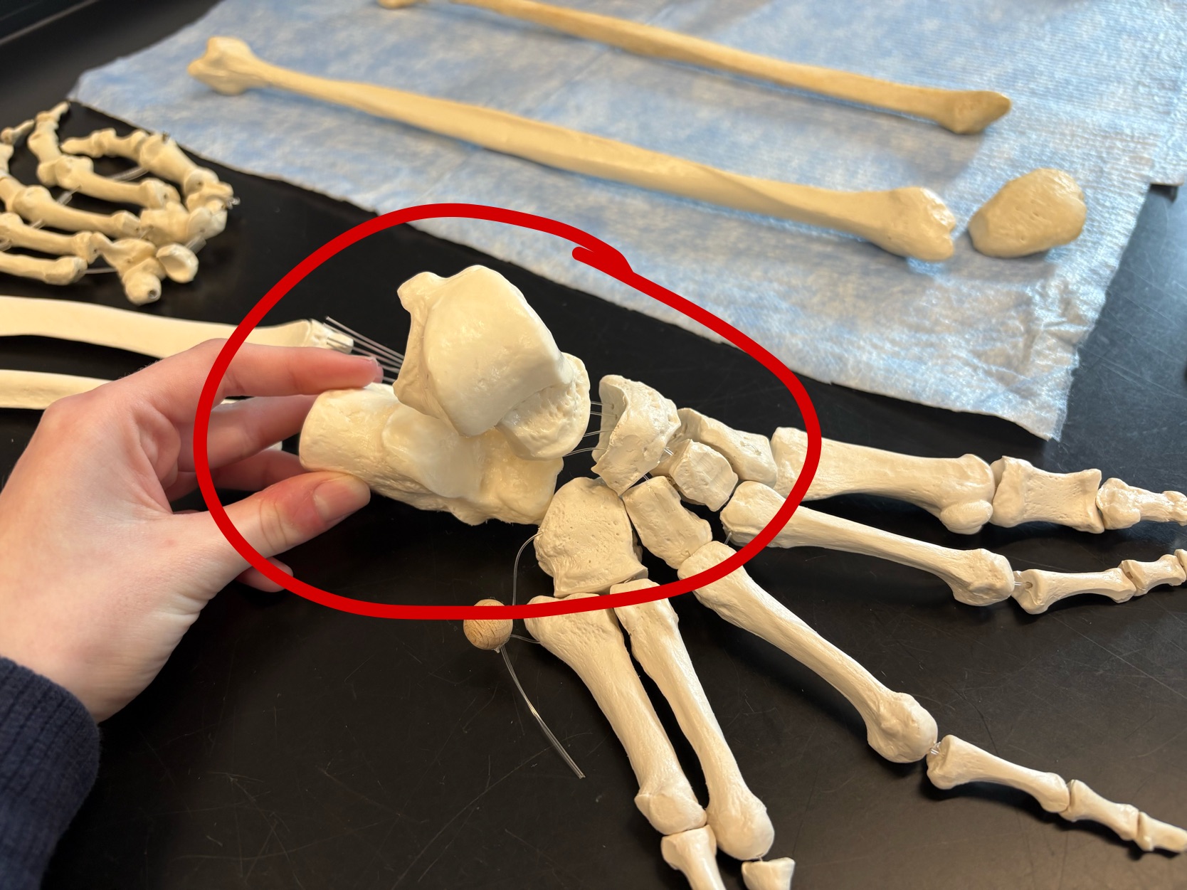 <p>Name these bones</p>