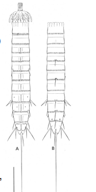 <p>Zelinkaderes floridensis (Cyclorhagida)</p><p>samice: A - introvert vychlípen, břišní strana; B - introvert zatažen, uzavřen 2. zonitem, hřbetní strana; měříko 100 µm</p>