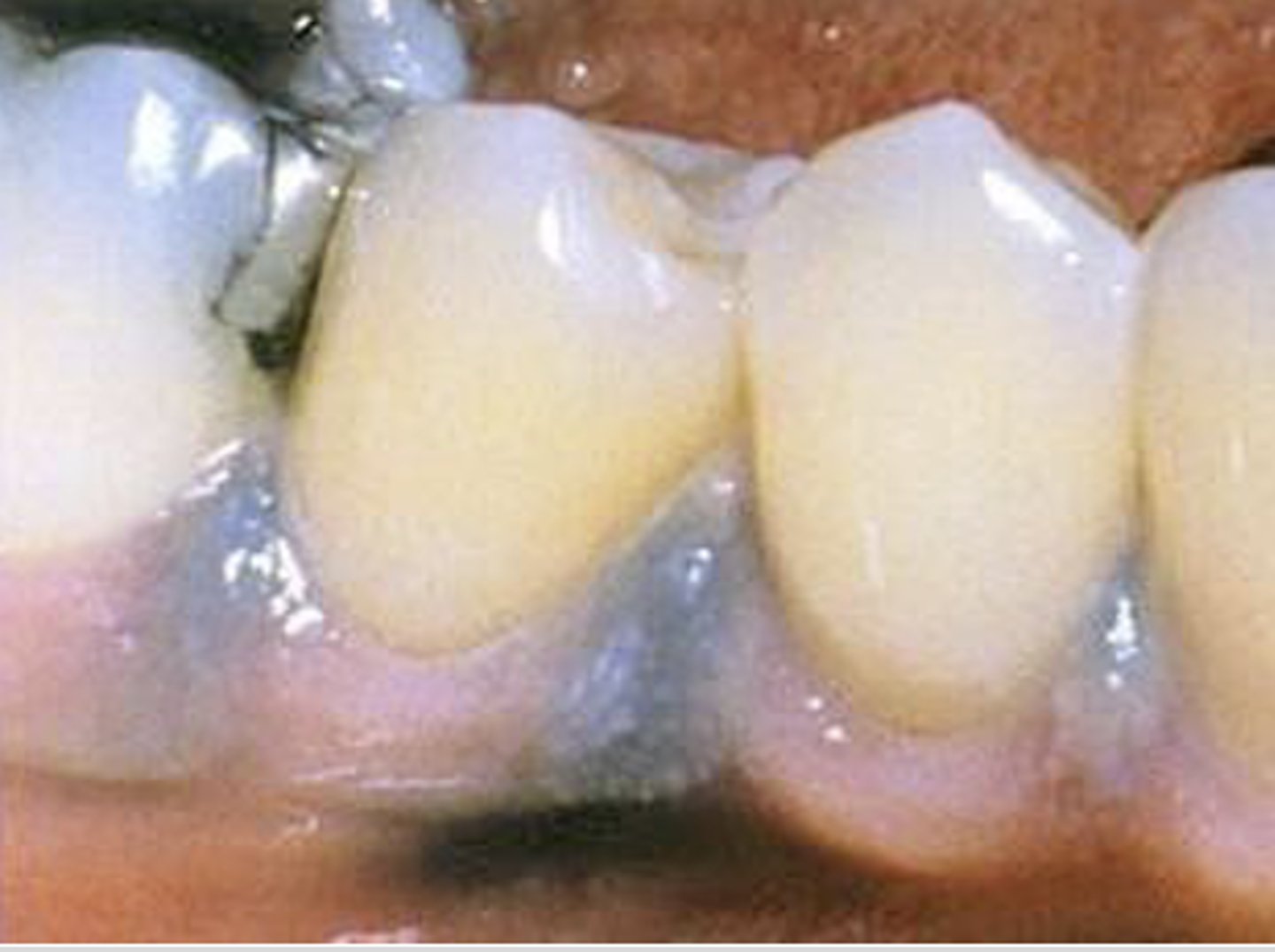 <p>What type of pigmented lesion?</p>