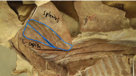 <p><span>Epaxial Muscles (Neck region)</span></p><p><span>(Innervated by dorsal branches of spinal nerves)</span></p>
