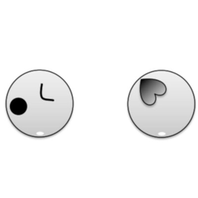 <p>What is the feral lie based on the anatomy showed?</p>