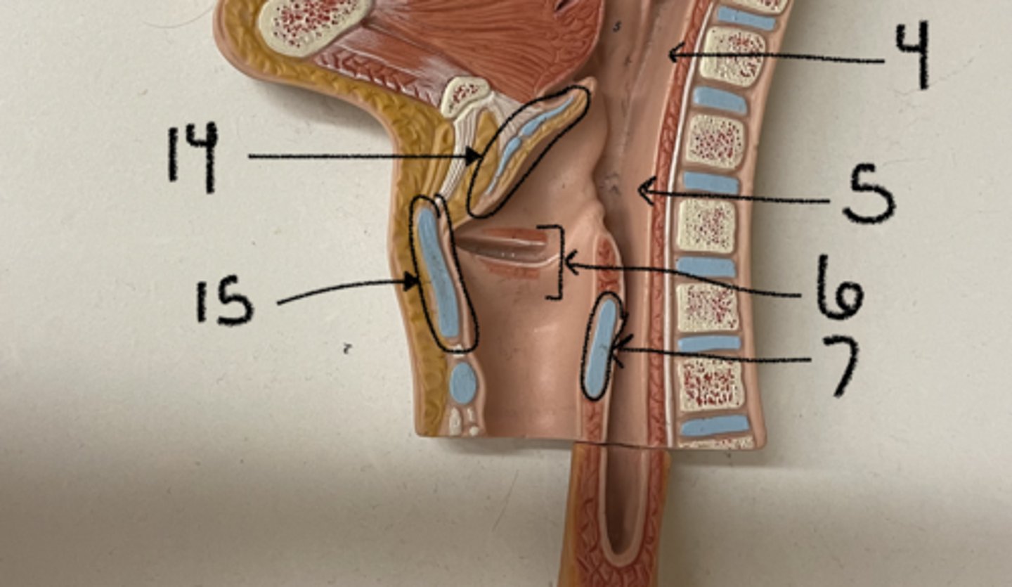 <p>what is structure 14</p>