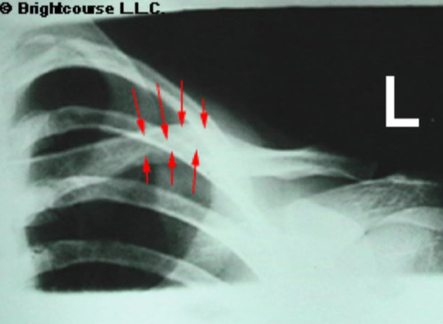 <p>What is being pointed out by the arrows in the image?</p>