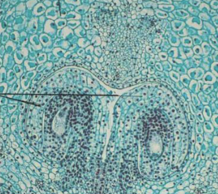 <p>Which structure is being shown?</p>