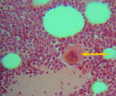 <p>Fragmentation of this MEGAKARYOCYTE will produce what?</p>