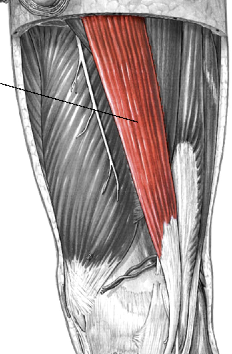 <p>Which muscle of the femur is:</p><ul><li><p>Inferior to adductor magnus</p></li><li><p>Action: adduct hip &amp; medial rot knee</p></li><li><p>Nerve: obturator</p></li></ul><p></p>