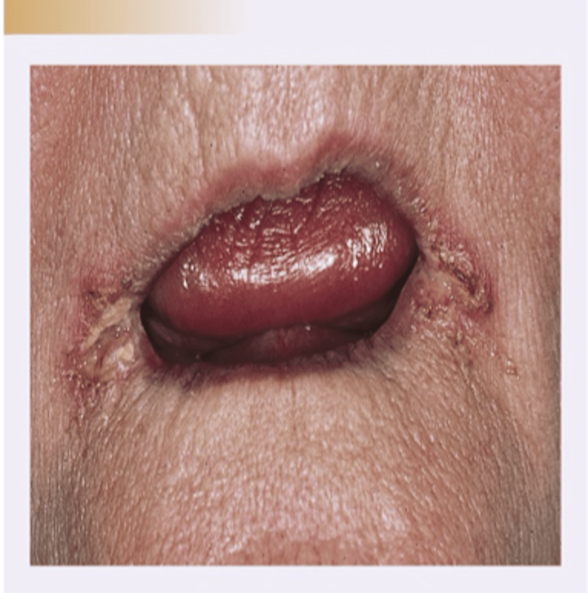 <p>Diagnosis?</p>