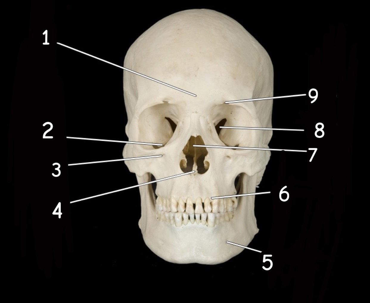 term image