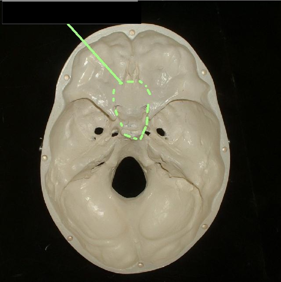 <p>middle of the skull, view of the top of the skull; above petrous portion</p>