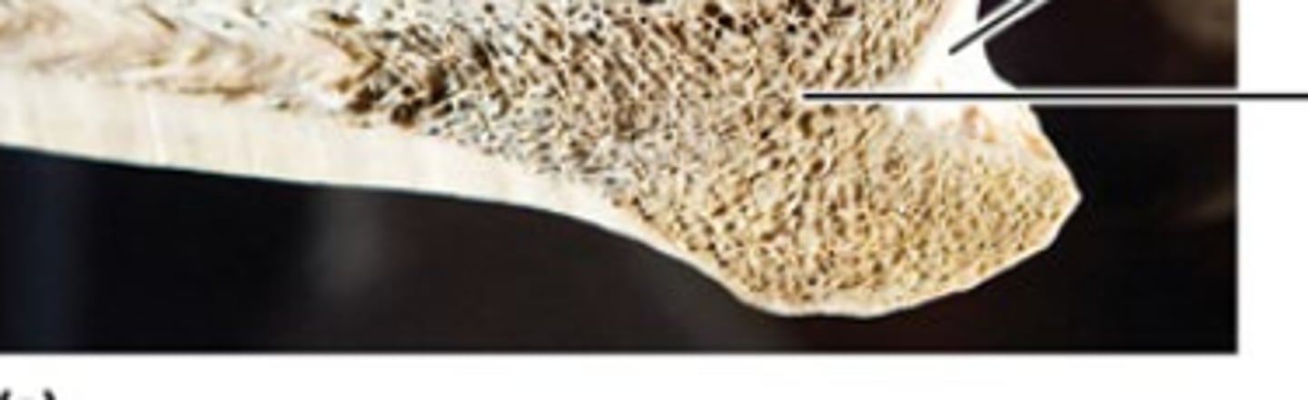 <p>What part of the bone is this?</p>