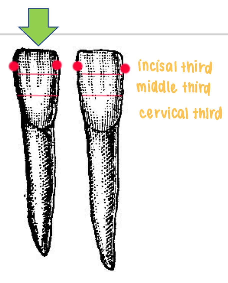 <p>what is the contact area of the mesial and distal side of the mandibular central incisor?</p><p>[special notes]</p><ul><li><p>only the central incisors (on both maxillary and mandibular) teeth have mesial to mesial contact</p></li><li><p>the mesial and distal contacts of the mandibular central incisor are at the same incisocervical position</p></li></ul>