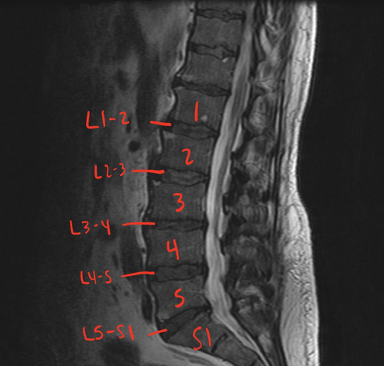 <p>what is this image?</p>