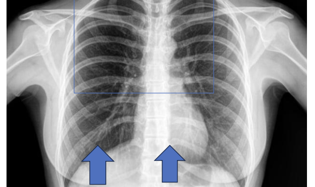 <p>Identify the structure ? View?</p>